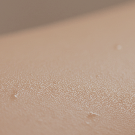 Calmer skin