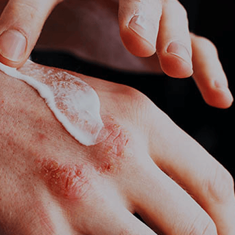 Less itching